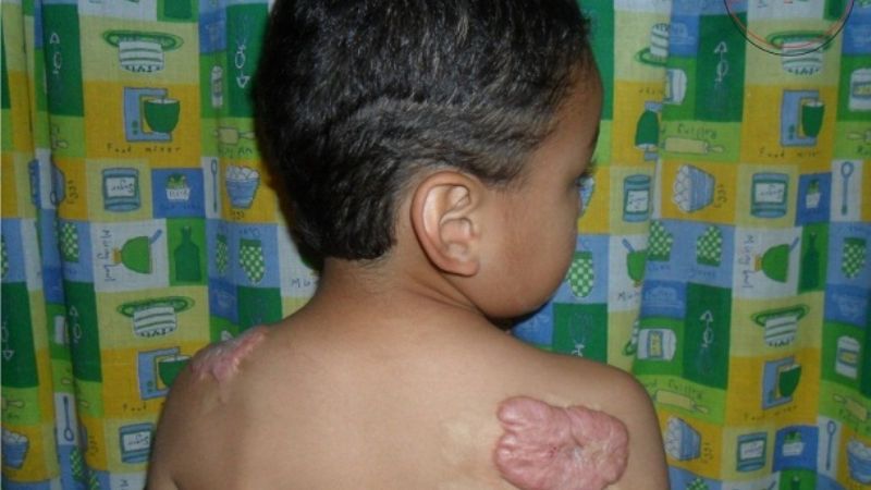 En Fiambalá, padres desesperados piden ayuda para su hijo