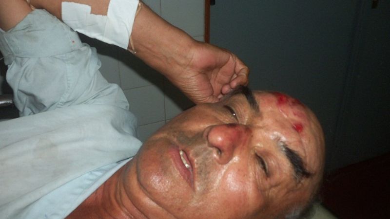 Tras desmayarse sufrió fuertes golpes en su cabeza