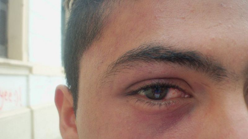 Denuncian a policías de Los Castillos por agredir a un menor