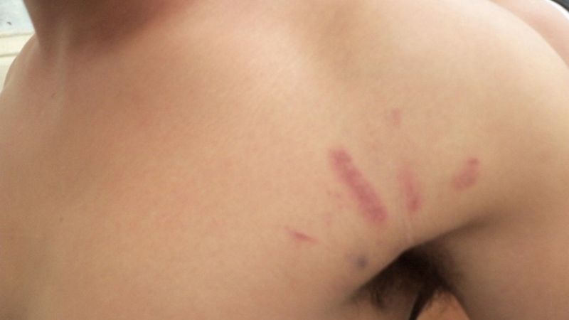 Denuncian a policías de Los Castillos por agredir a un menor