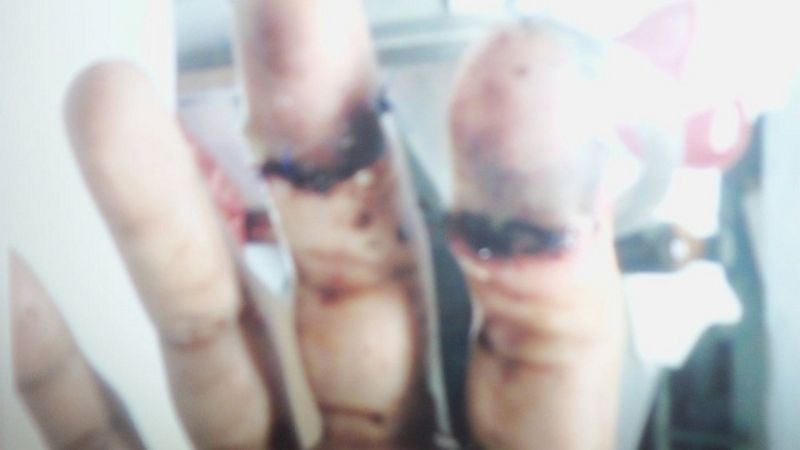 Operario textil sufrió un grave accidente