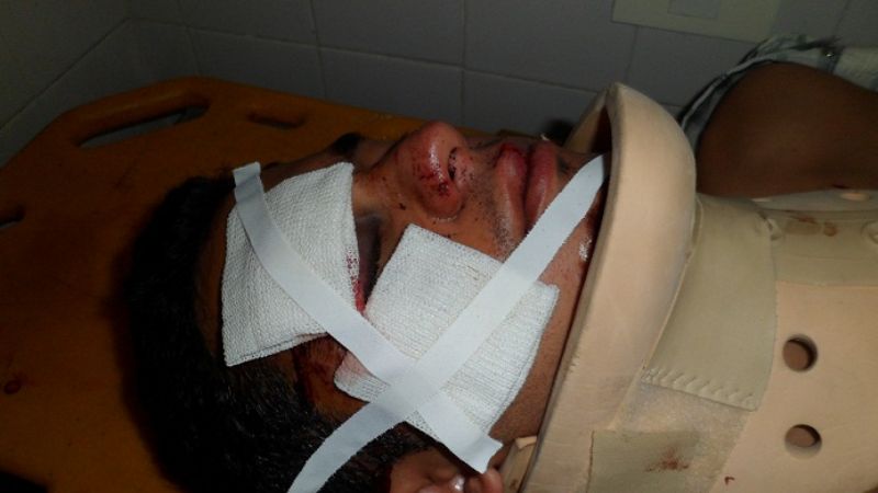 Joven se cayó de la moto y sufrió importantes heridas