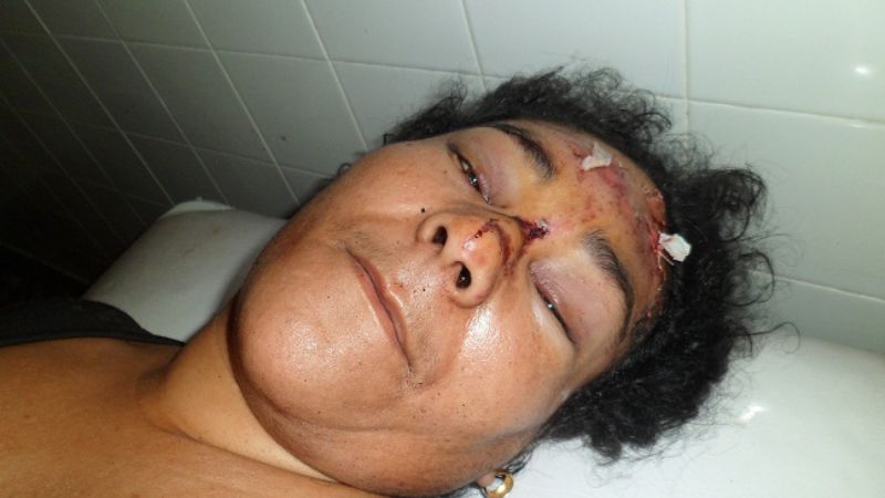  Choque de motos en Londres