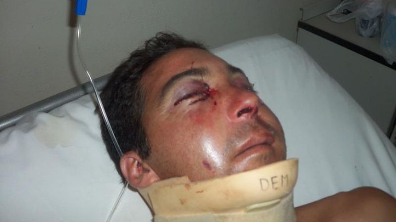 Jugador de fútbol fue brutalmente patoteado a la salida de un boliche