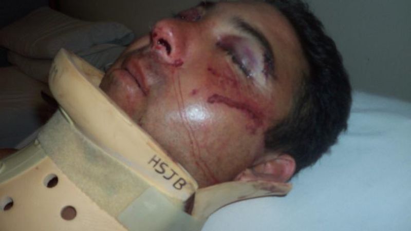 Jugador de fútbol fue brutalmente patoteado a la salida de un boliche