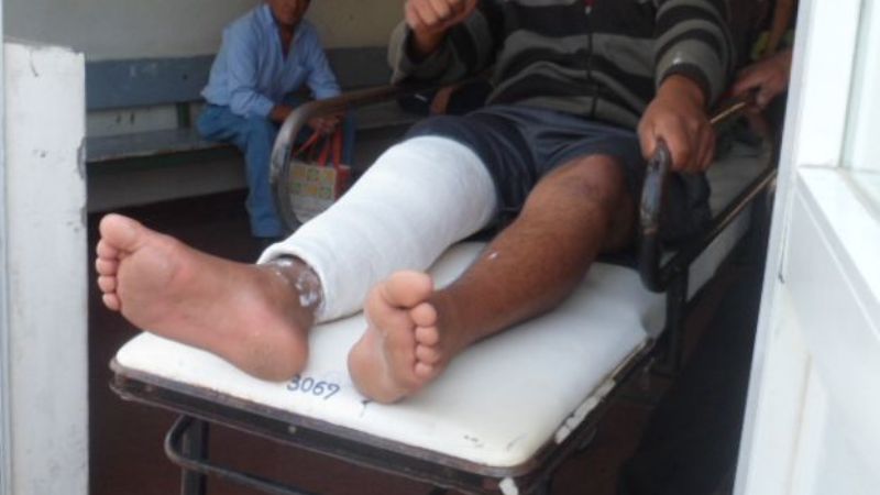 Derrapó con su moto y sufrió rotura de ligamentos