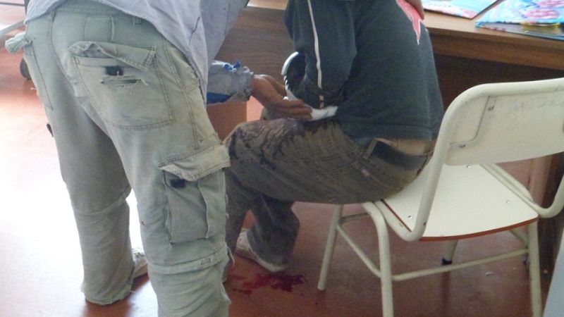 Grave estado de un hombre que se incrustó una amoladora en el brazo