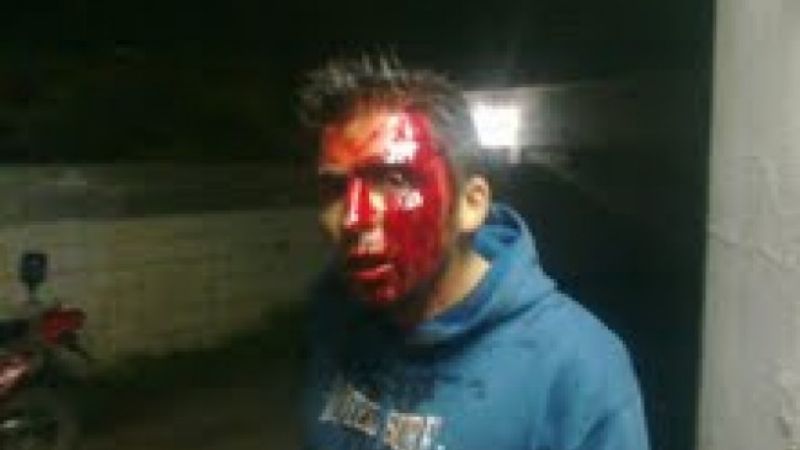 Periodista denunció que fue golpeado