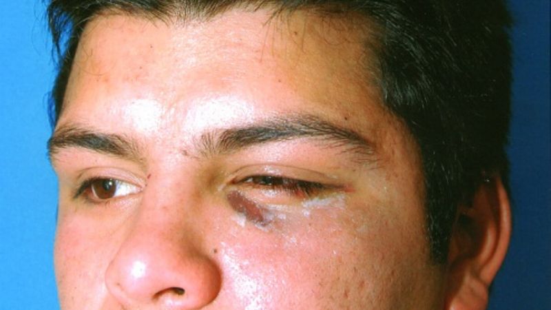 Padre denuncia golpiza de policías contra su hijo