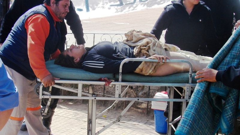 La mujer que se prendió fuego tiene quemaduras de tercer grado