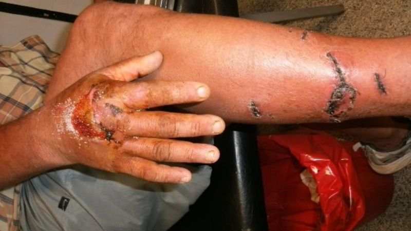 Jauría atacó ferozmente a un vecino