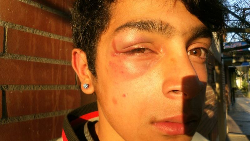Menor, en boliche, denuncia a policía por golpiza