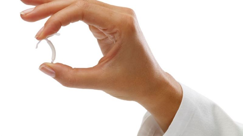 Las mujeres pueden acceder a consejería sobre el DIU