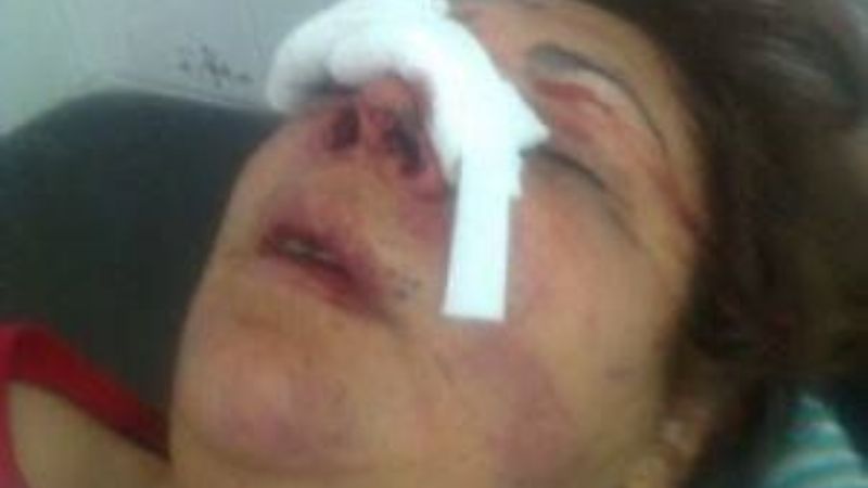 Le destrozó la cara mas de una vez y seguirá libre