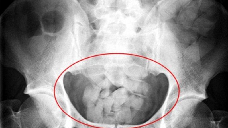 Detuvieron a tres “mulas” bolivianas