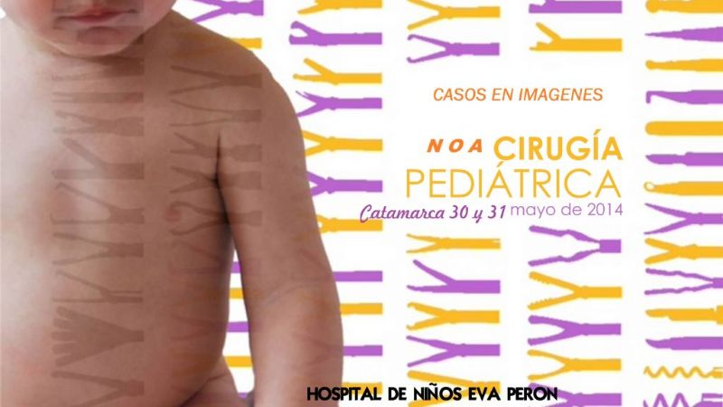 Jornadas de Cirugias Pediátricas