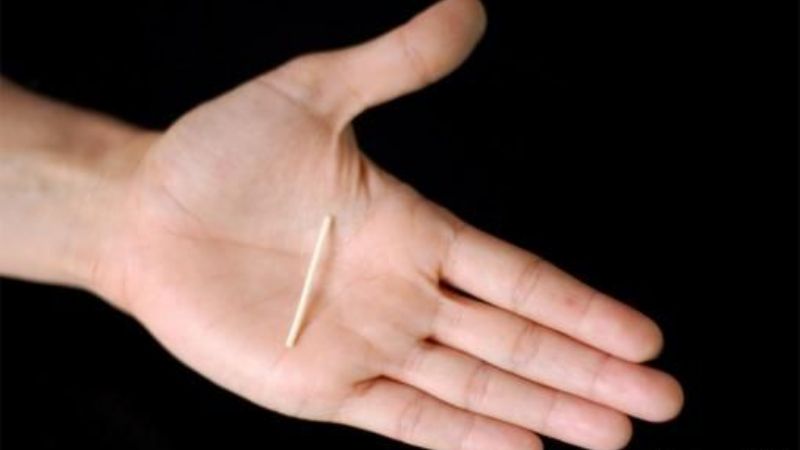 Presentan un nuevo método anticonceptivo destinado a adolescentes