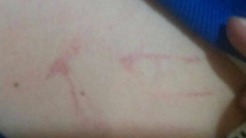 Violencia y Alcohol en festejo de la Franja Morada