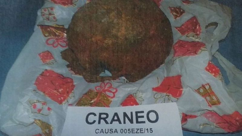 Turista fue demorado en Ezeiza por llevar un cráneo en la valija