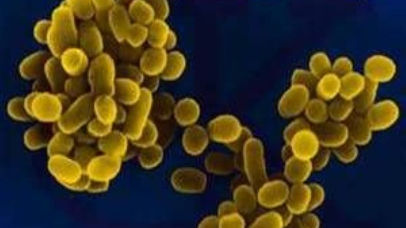 Medidas preventivas para evitar la brucelosis