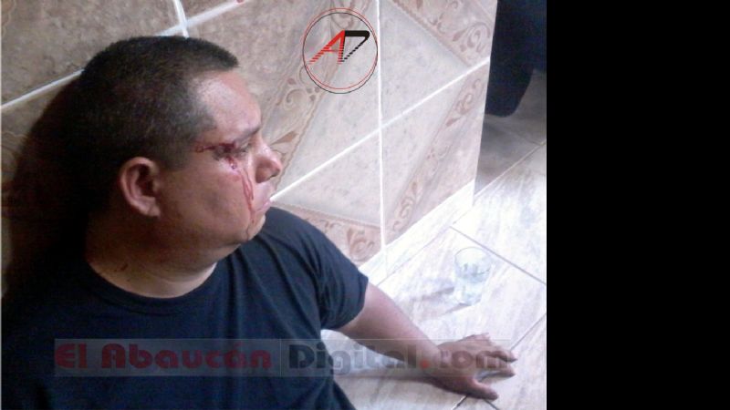 Periodista agredido por una patota en Tinogasta