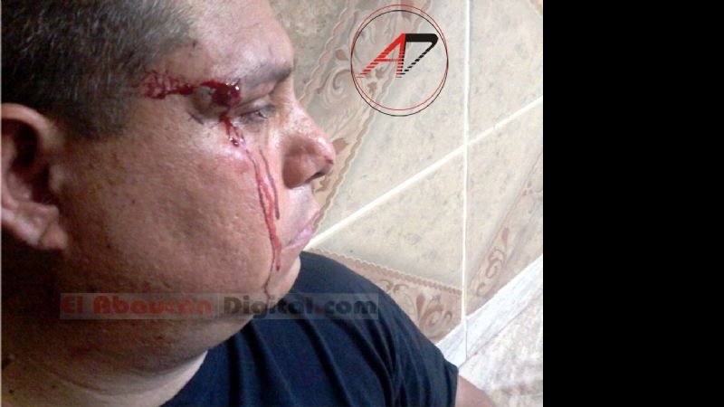 Periodista agredido por una patota en Tinogasta