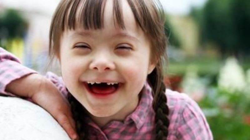 Día Mundial del Síndrome de Down