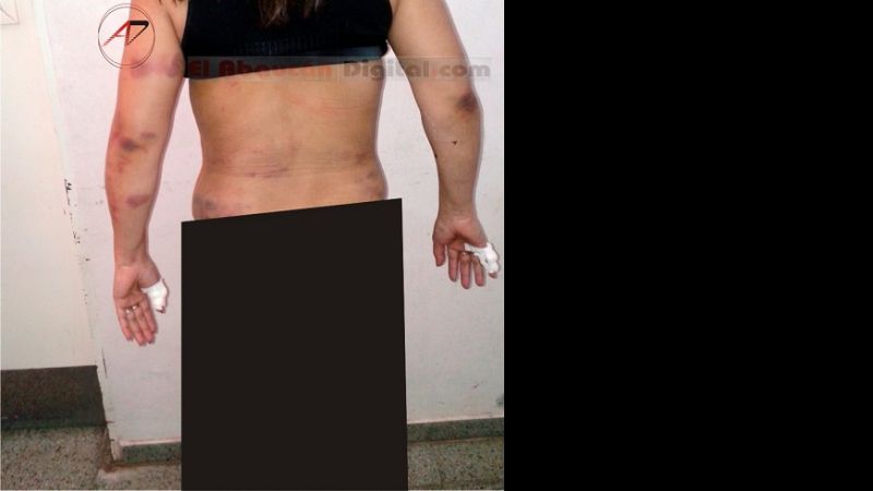 Empeoró el estado de salud de la docente brutalmente agredida