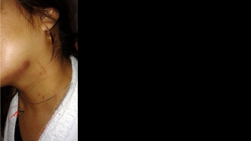 Empeoró el estado de salud de la docente brutalmente agredida