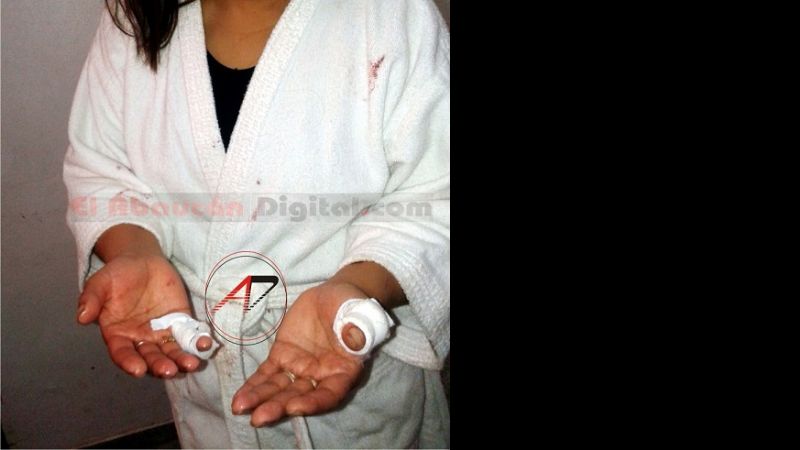 Imágenes de la feroz golpiza que docente recibió de su ex pareja