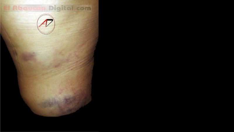 Imágenes de la feroz golpiza que docente recibió de su ex pareja