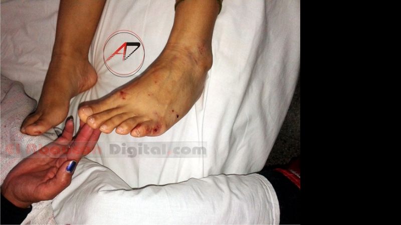 Imágenes de la feroz golpiza que docente recibió de su ex pareja