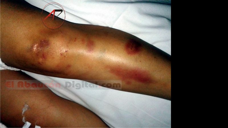 Imágenes de la feroz golpiza que docente recibió de su ex pareja