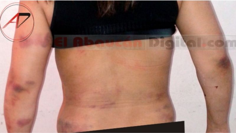 La docente se encuentra en terapia intensiva y el agresor continúa en libertad