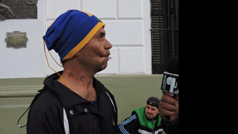 Ex imputado se cosió la boca porque no consigue trabajo