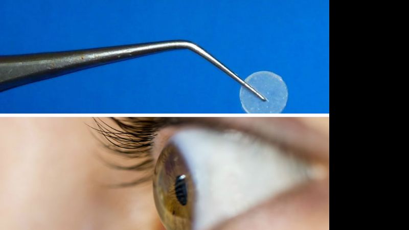 Un film ocular bioadhesivo para tratar el glaucoma