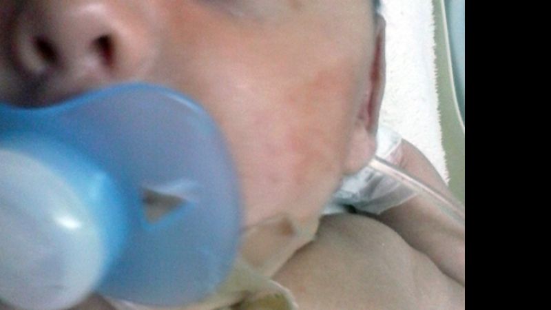 Enfermera tapó la boca a bebé con un chupete y cinta adhesiva toda la noche