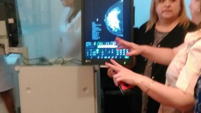 El Hospital San Juan Bautista recibió un Mamógrafo de última generación