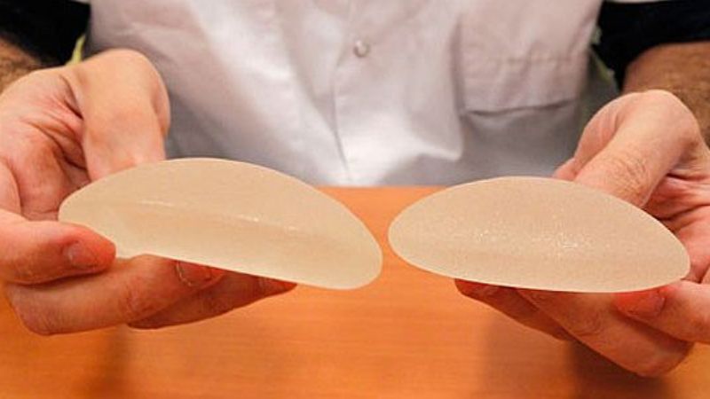 Prohíben venta y uso de implantes mamarios de firma brasileña