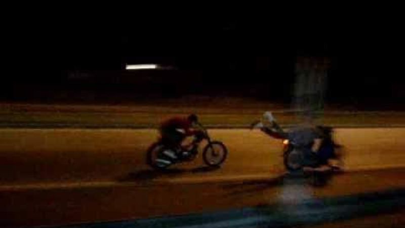 Menor en moto corría picadas acostado y perdió cuatro dedos