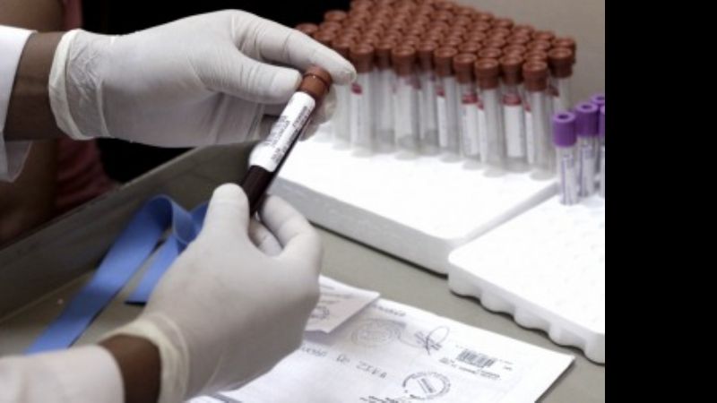 El zika aumenta los casos del síndrome de Guillain Barré que causa parálisis