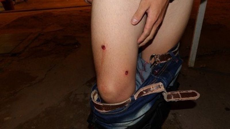 En Saujil hubo incidentes con otra exagerada reacción de la Policía