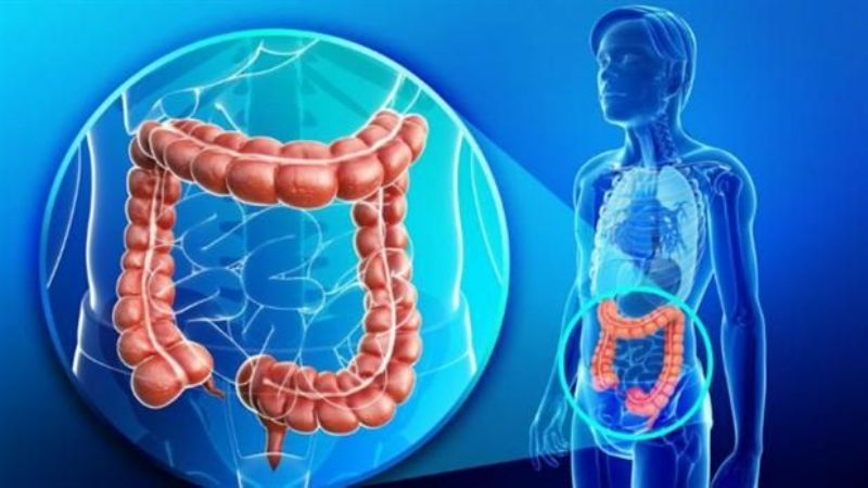 Cáncer de colon: aparece a partir de los 40 y causa 17 muertes por día en el país