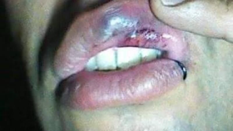 Cordobesa denuncia que fue salvajemente agredida por policías en Catamarca