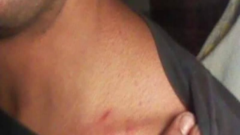 Cordobesa denuncia que fue salvajemente agredida por policías en Catamarca