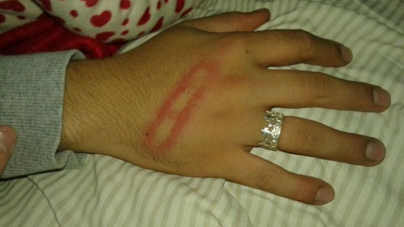 Cordobesa denuncia que fue salvajemente agredida por policías en Catamarca