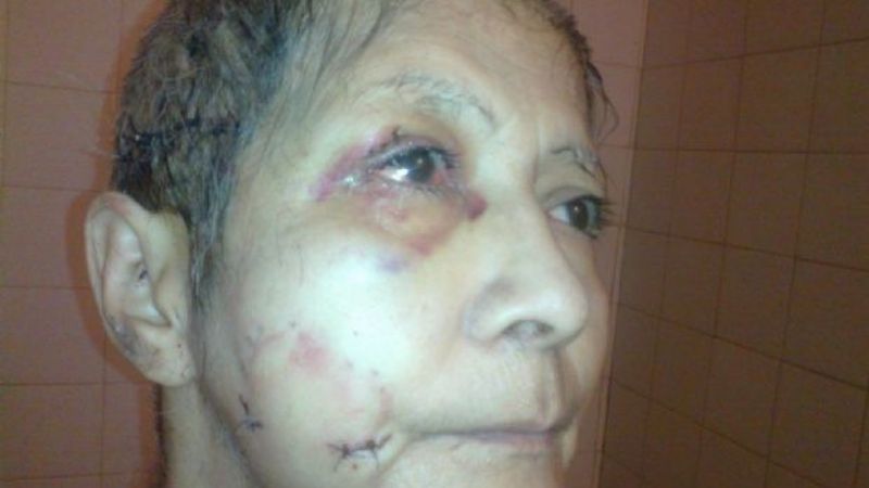 Una mujer sufrió gravísimas heridas al ser atacada por perros Pampa