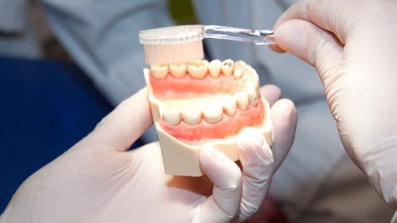 Denunció a un mecánico dental por estafarlo con sus prótesis