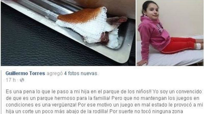 Se lastimó en un juego del Parque de los niños