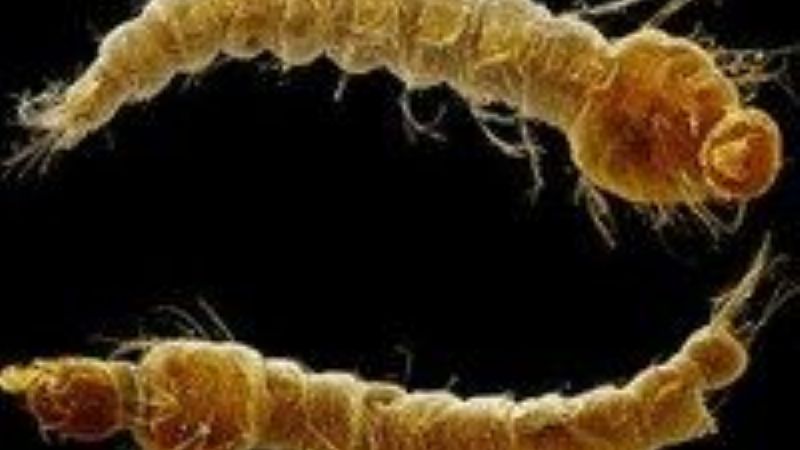 Hidatidosis en Andalgalá